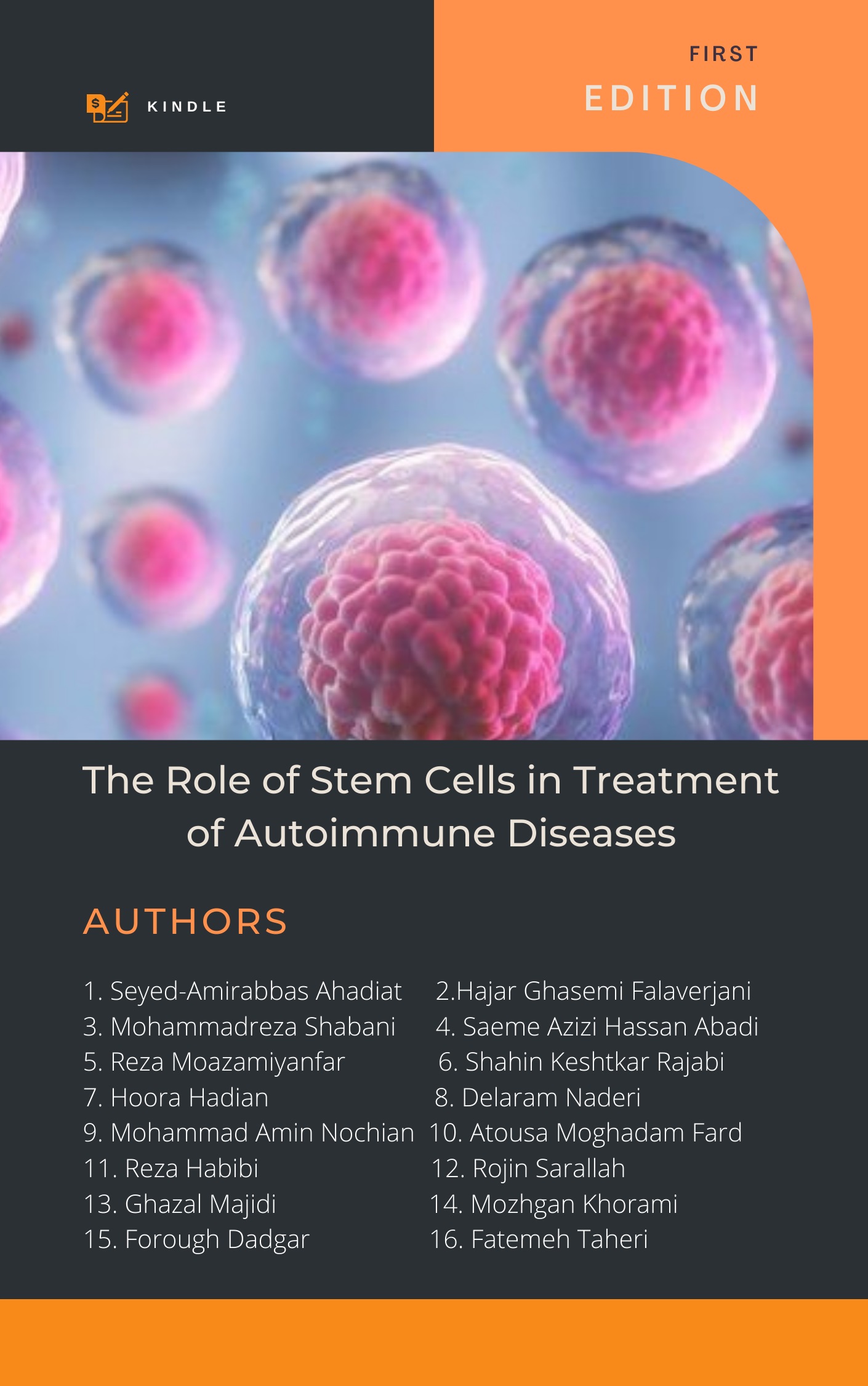 The Role of Stem Cells in Treatment of Autoimmune Diseases